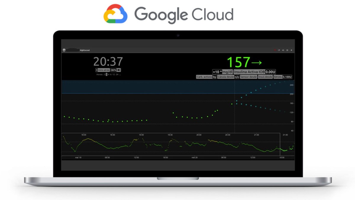 Despliega Nightscout en Google Cloud de forma gratuita como alternativa a&nbsp;Heroku