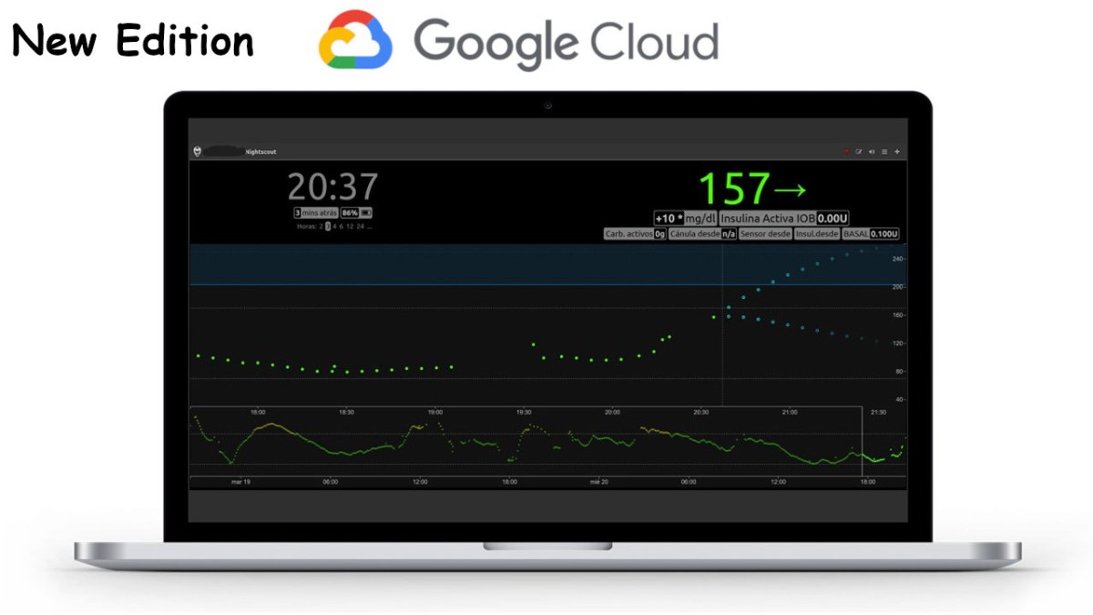 Despliega Nightscout en Google Cloud. Nueva versión&nbsp;(v5)